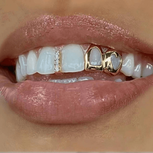 A patient displaying shiny decorative crystals on their teeth for a personalized look