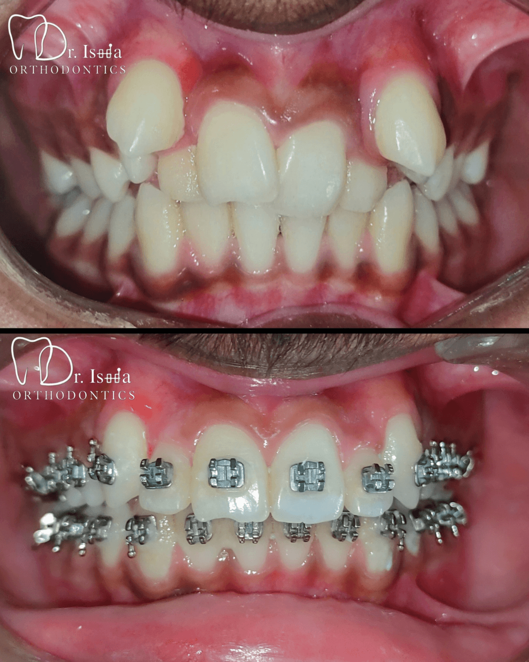 Smile transformation 2